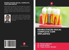 REABILITAÇÃO BUCAL COMPLETA COM IMPLANTES - Agrawal, Dr. Manan;Kumar, Dr. Anish;Mandal, Dr. Tapan Kumar