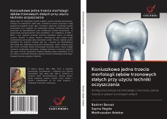 Koniuszkowa jedna trzecia morfologii z¿bów trzonowych sta¿ych przy u¿yciu techniki oczyszczania - Bansal, Rashmi; Hegde, Sapna; Astekar, Madhusudan