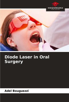 Diode Laser in Oral Surgery - Bouguezzi, Adel