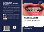 Jextrakciq protiw neäxtrakcionnogo lecheniq w ortodontii