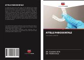 ATTELLE PARODONTALE