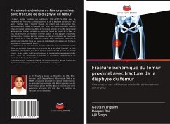 Fracture ischémique du fémur proximal avec fracture de la diaphyse du fémur - Tripathi, Gautam; Rai, Deepak; Singh, Ajit