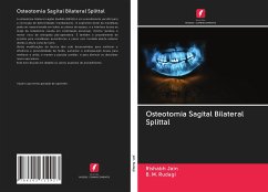 Osteotomia Sagital Bilateral Splittal - Jain, Rishabh; Rudagi, B. M.