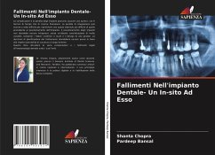 Fallimenti Nell'impianto Dentale- Un In-sito Ad Esso - Chopra, Shanta;Bansal, Pardeep