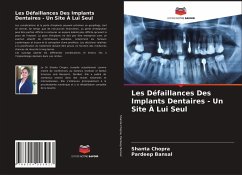 Les Défaillances Des Implants Dentaires - Un Site À Lui Seul - Chopra, Shanta;Bansal, Pardeep