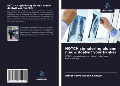 NOTCH signalering als een nieuw doelwit voor kanker - Nwabo Kamdje, Armel Herve