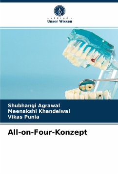 All-on-Four-Konzept - Agrawal, Shubhangi;Khandelwal, Meenakshi;Punia, Vikas