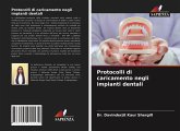 Protocolli di caricamento negli impianti dentali