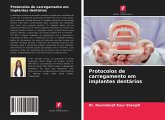 Protocolos de carregamento em implantes dentários