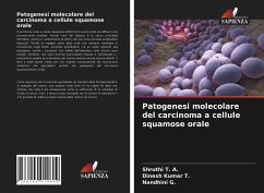 Patogenesi molecolare del carcinoma a cellule squamose orale - T. A., Shruthi;T., Dinesh Kumar;G., Nandhini