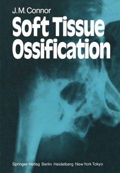 Cover Soft Tissue Ossification (eBook, PDF)