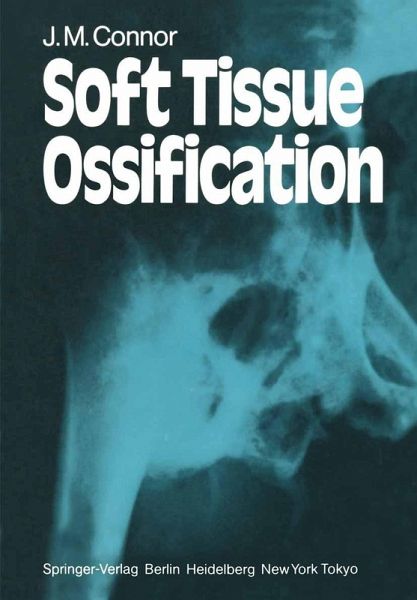 Soft Tissue Ossification (eBook, PDF) Soft Tissue Ossification (eBook, PDF)