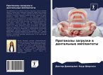 Protokoly zagruzki w dental'nye implantaty