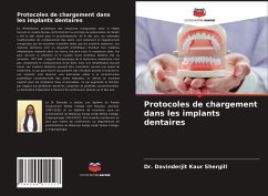 Protocoles de chargement dans les implants dentaires - Shergill, Davinderjit Kaur