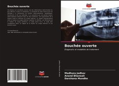 Bouchée ouverte - Jadhav, Madhura;Bhansali, Anand;Mundhe, Darshana