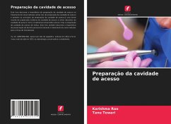 Preparação da cavidade de acesso - Rao, Karishma;Tewari, Tanu