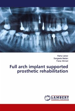 Full arch implant supported prosthetic rehabilitation