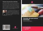 Facetas de porcelana laminada