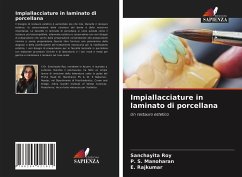 Impiallacciature in laminato di porcellana - Roy, Sanchayita;Manoharan, P. S.;Rajkumar, E.