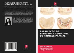 FABRICAÇÃO DE ESTRUTURA REMOVÍVEL DE PRÓTESE PARCIAL - Agarwal, Arushi;Agarwal, Garima;Srivastava, Virag