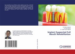 Implant Supported Full Mouth Rehabilitation