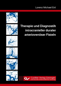 Therapie und Diagnostik intracranieller duraler arteriovenöser Fisteln - Ertl, Lorenz Michael