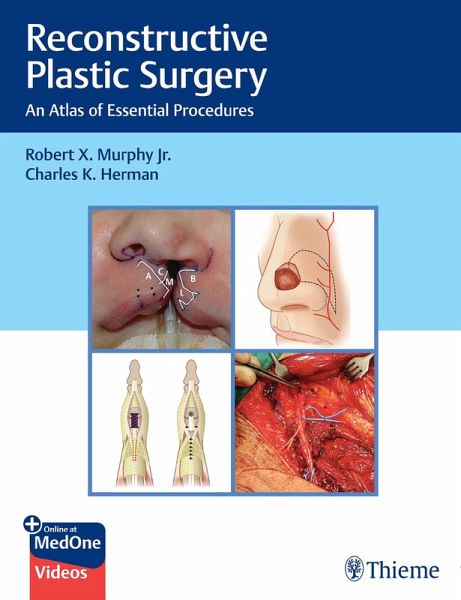 Reconstructive Plastic Surgery (eBook, ePUB) Reconstructive Plastic Surgery (eBook, ePUB)