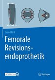 Femorale Revisionsendoprothetik (eBook, PDF)