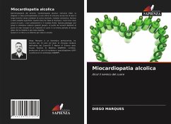 Miocardiopatia alcolica - Marques, Diego