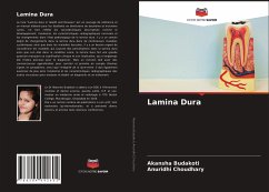 Lamina Dura - Budakoti, Akansha;Choudhary, Anuridhi