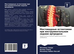 Cover Mostowidnye osteotomii pri instrumental'nom zadnem artrodeze