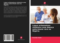 Lúpus eritematoso sistémico uma doença auto-imune rara na Nigéria - Kabir, Rashida