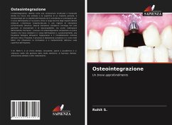 Cover Osteointegrazione