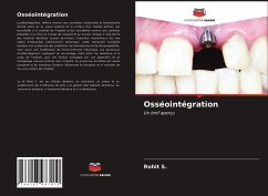 Osséointégration - S., Rohit