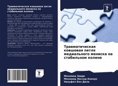 Trawmaticheskaq kowshowaq petlq medial'nogo meniska na stabil'nom kolene - Zairi, Mohamed;Kanoun, Mohamed Lassad;Ben Dali, Naoufel