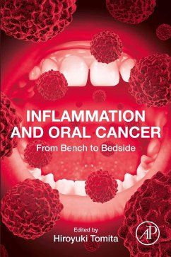 Inflammation and Oral Cancer (eBook, ePUB)