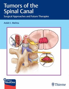 Tumors of the Spinal Canal - Mehta, Ankit I.