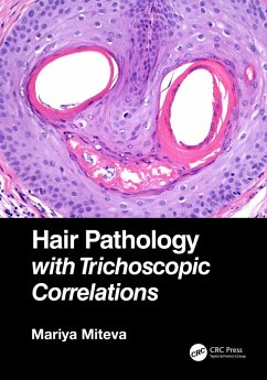 Cover Hair Pathology with Trichoscopic Correlations (eBook, PDF)