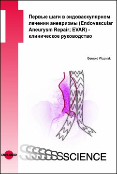 First steps in EVAR - a clinical guide - Russian edition (eBook, PDF) - Wozniak, Gernold