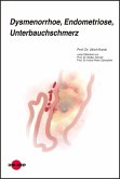 Dysmenorrhoe, Endometriose, Unterbauchschmerz (eBook, PDF) Dysmenorrhoe, Endometriose, Unterbauchschmerz (eBook, PDF)
