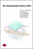 Die vitreomakuläre Traktion (VMT) (eBook, PDF)