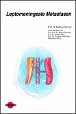 Leptomeningeale Metastasen (eBook, PDF)