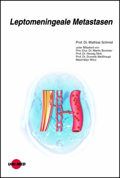 Leptomeningeale Metastasen (eBook, PDF) - Schmid, Mathias