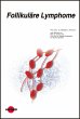 Follikuläre Lymphome (eBook, PDF) - Bild 1