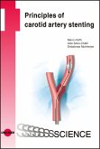 Principles of carotid artery stenting (eBook, PDF)