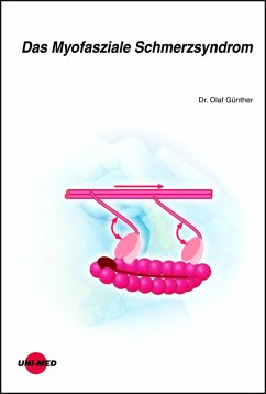 Das Myofasziale Schmerzsyndrom (eBook, PDF) - Günther, Olaf