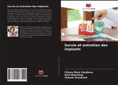 Survie et entretien des implants - Varghese, Chinnu Mary;Bhardwaj, Amit;Sheokand, Vidushi