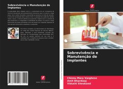 Sobrevivência e Manutenção de Implantes - Varghese, Chinnu Mary;Bhardwaj, Amit;Sheokand, Vidushi