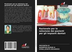 Razionale per la selezione dei pazienti per gli impianti dentali - M, PRIYANTHI;N, DHINEKSH KUMAR;DEVADOSS, Vimal Joseph