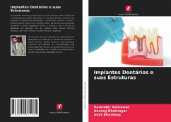 Implantes Dentários e suas Estruturas - Sehrawat, Harender;Bhatnagar, Anurag;Bhardwaj, Amit